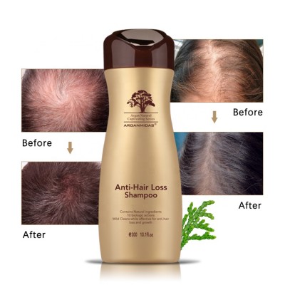 Magic China Anti Hair Loss Shampoo With Pack