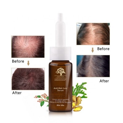 100% Guaranteed Hair Grow Anti - hair Loss Serum